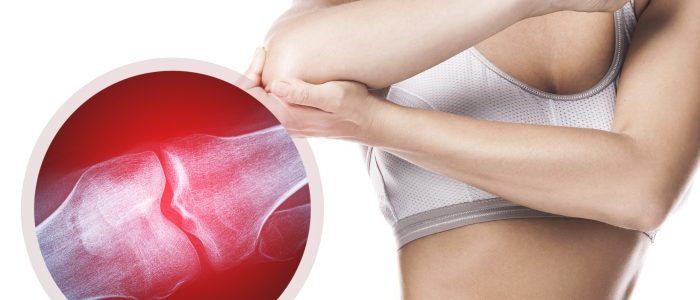 Female elbow and and X-ray effect with an injured joint